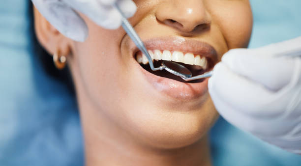 Best Emergency Treatment for Dental Infections or Abscesses in Seaside, CA